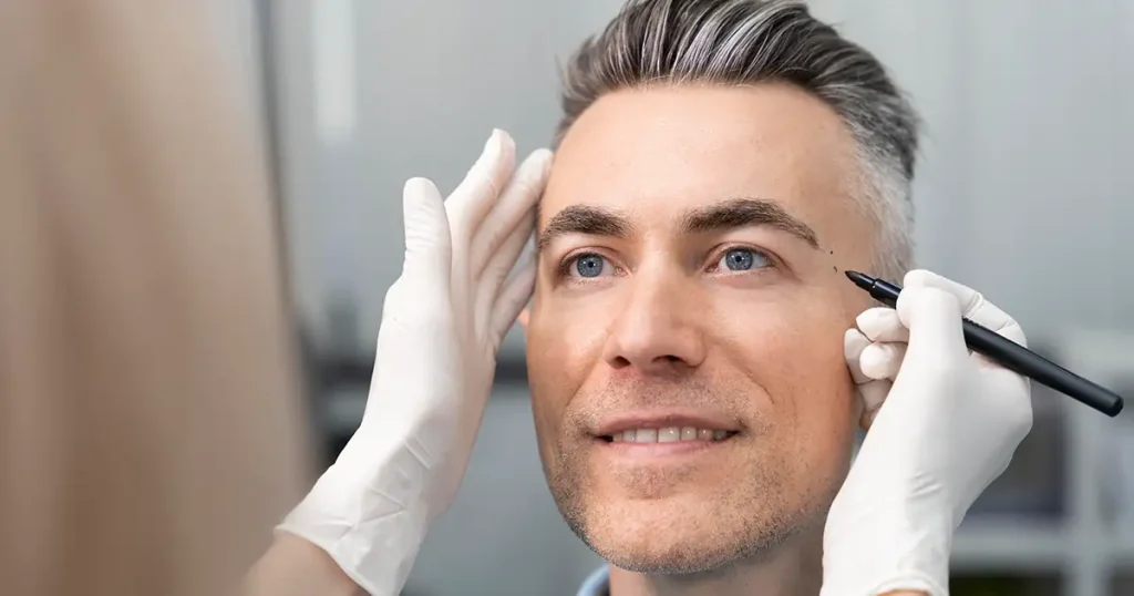 botox para homem em franca