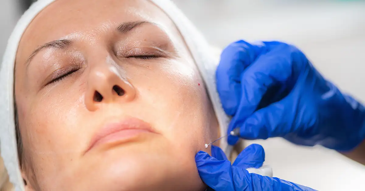 especialista em harmonização facial em franca fisiobeauty melhor avaliação