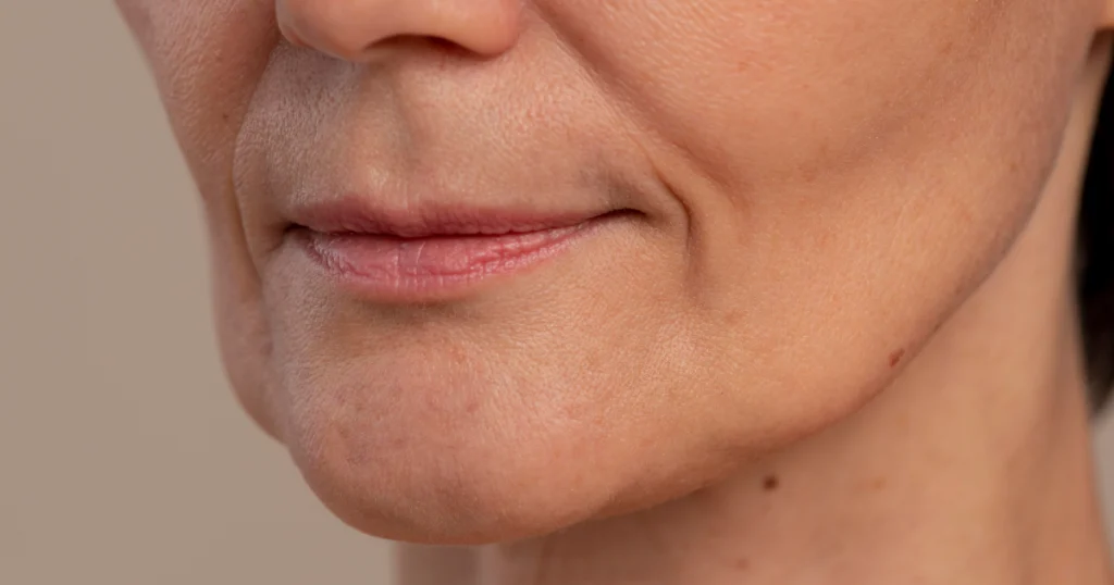 rejuvenescimento facial em Franca